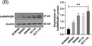 Fig.1.B showing Western Blotting in a Homo sapiens (Human) sample from the publication: hnRNPA2B1 drives colorectal cancer progression via the circCDYL/EIF4A3/PHF8 axis.