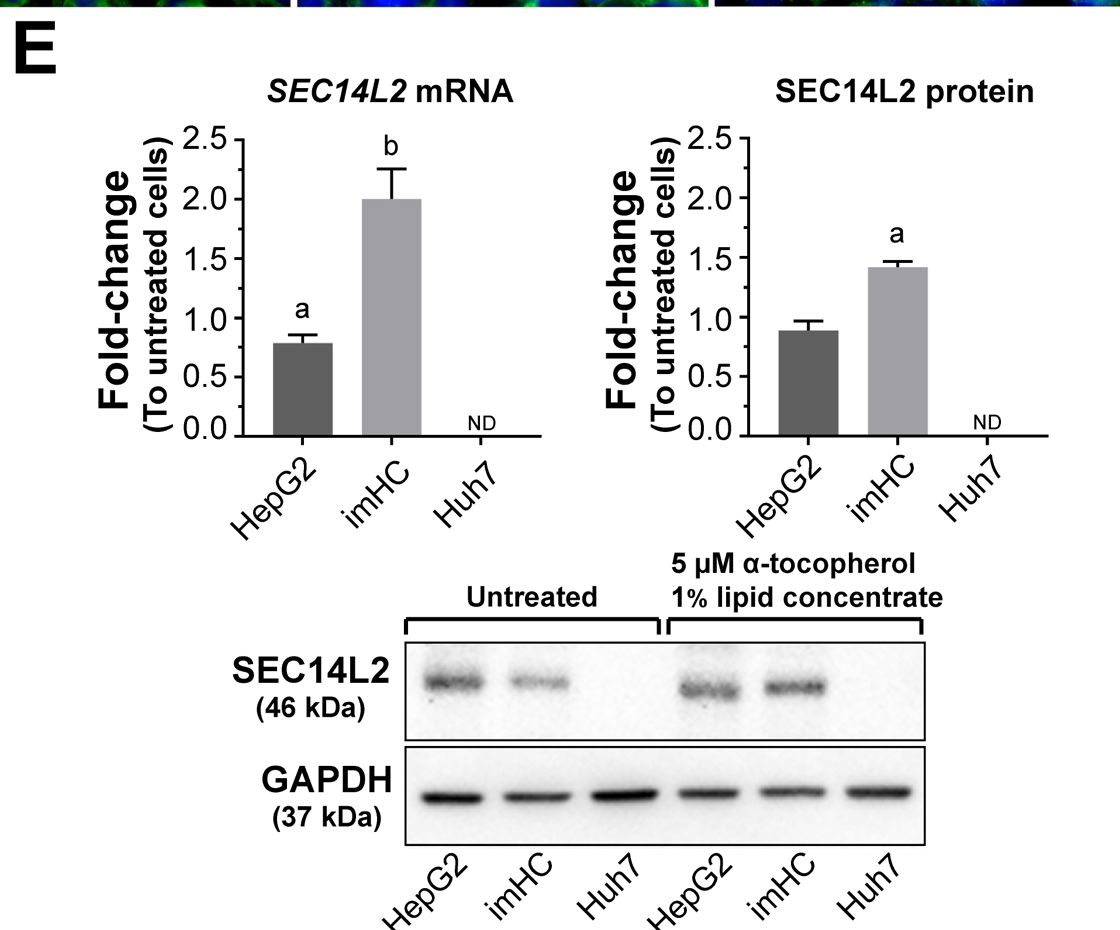 Fig.2.E showing Western Blotting in a Homo sapiens (Human) sample from the publication: Immortalized hepatocyte-like cells: A competent hepatocyte model for studying clinical HCV isolate infection.