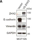 Fig.2.A showing Western Blotting from the publication: ZHX2 deficiency enriches hybrid MET cells through regulating E-cadherin expression.