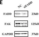 Fig.2.E showing Western Blotting from the publication: MiR-7a is an important mediator in Fas-associated protein with death domain (FADD)-regulated expression of focal adhesion kinase (FAK).