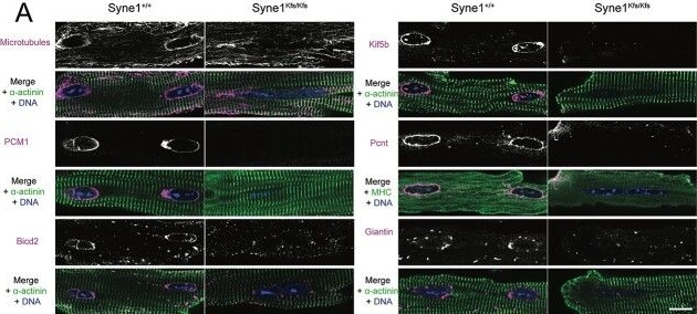 Fig.2.A showing Immunohistochemistry-immunofluorescence in a Mus musculus (House mouse) sample from the publication: Nesprin-1 LINC complexes recruit microtubule cytoskeleton proteins and drive pathology in Lmna-mutant striated muscle.