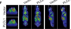 Fig.7.F showing Immunocytochemistry-immunofluorescence in a Mus musculus (House mouse) sample from the publication: PLCL1 suppresses tumour progression by regulating AMPK/mTOR-mediated autophagy in renal cell carcinoma.