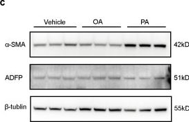 Fig.4.C showing Western Blotting from the publication: Integrated multi-platform metabolomics reveals fatty acid-mediated inflammatory signatures in pretibial myxedema.