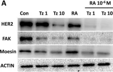 Fig.10.A showing Western Blotting from the publication: Synergistic antitumor activity by combining trastuzumab with retinoic acid in HER2 positive human breast cancer cells.