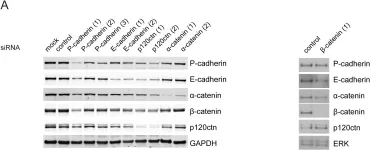 Fig.5.A showing Western Blotting in a Homo sapiens (Human) sample from the publication: p120ctn and P-cadherin but not E-cadherin regulate cell motility and invasion of DU145 prostate cancer cells.