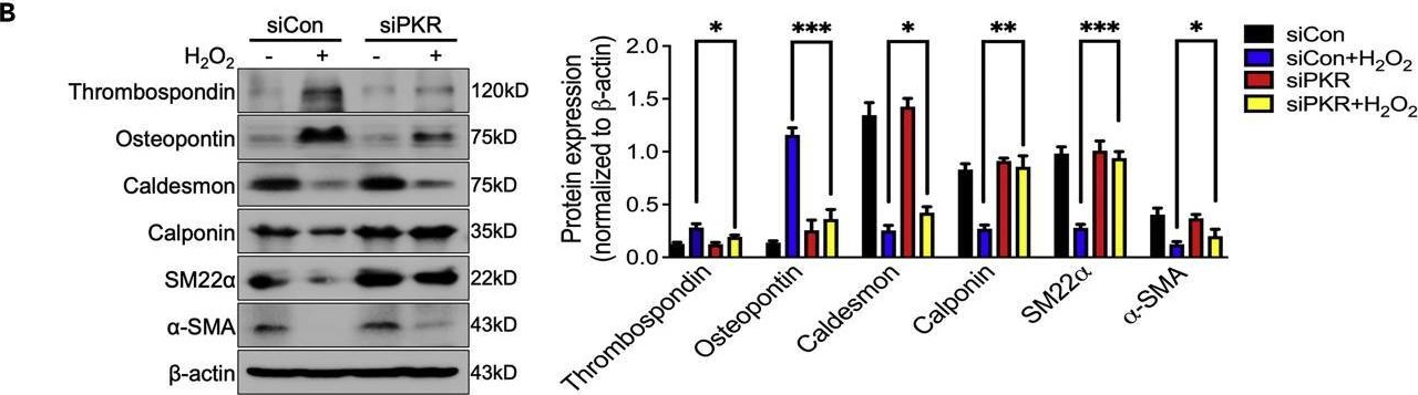 Fig.7.B showing Western Blotting in a Homo sapiens (Human) sample from the publication: PKR deficiency delays vascular aging via inhibiting GSDMD-mediated endothelial cell hyperactivation.