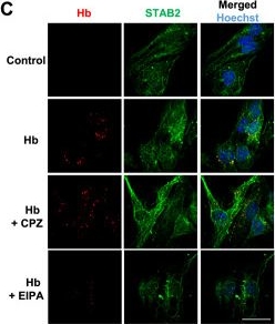 Fig.9.C showing Immunocytochemistry-immunofluorescence in a Mus musculus (House mouse) sample from the publication: Liver sinusoidal endothelial cells constitute a major route for hemoglobin clearance.