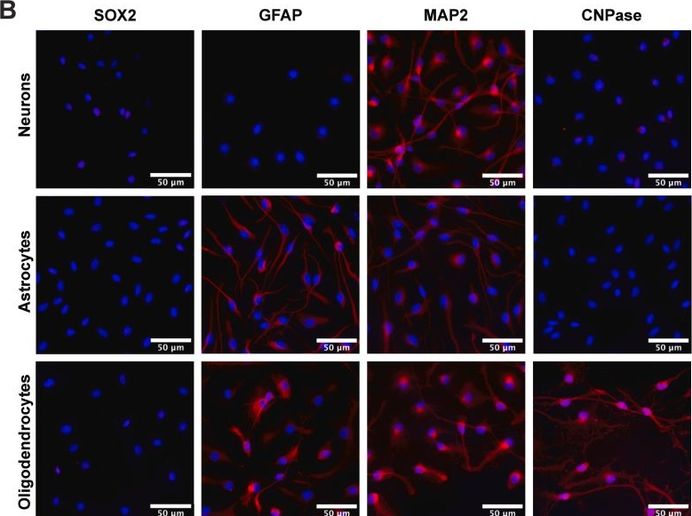 Fig.3.B showing Immunocytochemistry-immunofluorescence in a Homo sapiens (Human) sample from the publication: Comprehensive characterization of the human neural stem cell line HNSC.100 as a versatile model for neurobiological research.