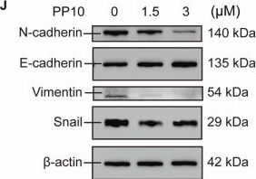 Fig.10.J showing Western Blotting from the publication: AI-identified CD133-targeting natural compounds demonstrate differential anti-tumor effects and mechanisms in pan-cancer models.