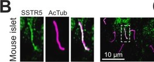 Fig.10.B showing Immunohistochemistry-immunofluorescence from the publication: Somatostatin triggers local cAMP and Ca2+ signaling in primary cilia to modulate pancreatic β-cell function.