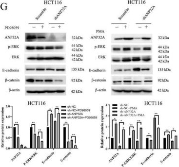 Fig.5.G showing Western Blotting in a Homo sapiens (Human) sample from the publication: ANP32A Knockdown Attenuates the Malignant Biological Behavior of Colorectal Cancer Cells by Suppressing Epithelial-mesenchymal Transition and ERK Activation.