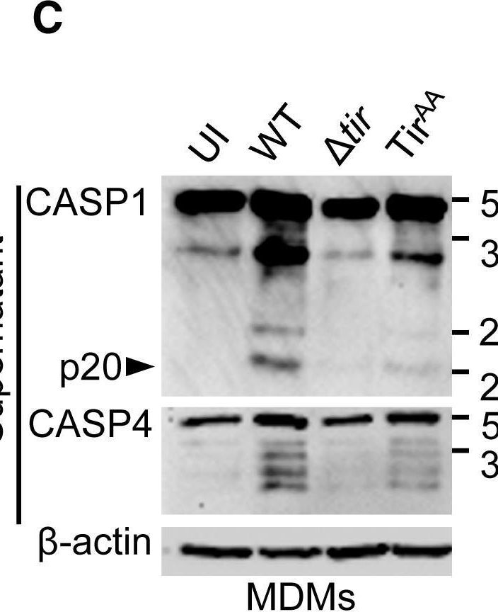 Fig.5.C showing Western Blotting in a Homo sapiens (Human) sample from the publication: Enteropathogenic Escherichia coli Stimulates Effector-Driven Rapid Caspase-4 Activation in Human Macrophages.