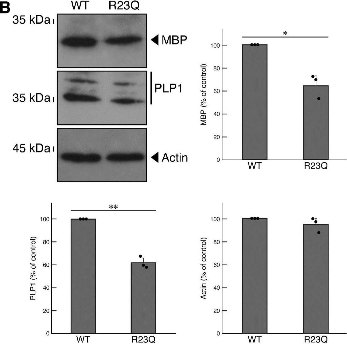 Fig.5.B showing Western Blotting in a Mus musculus (House mouse) sample from the publication: Hypomyelinating Leukodystrophy 14 (HLD14)-Related UFC1 p.Arg23Gln Decreases Cell Morphogenesis: A Phenotype Reversable with Hesperetin.