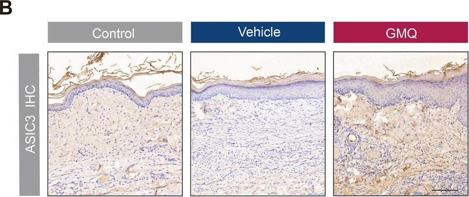 Fig.5.B showing Immunohistochemistry from the publication: The ASIC3-M-CSF-M2 macrophage-positive feedback loop modulates fibroblast-to-myofibroblast differentiation in skin fibrosis pathogenesis.