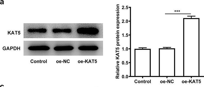 Fig.5.A showing Western Blotting in a Homo sapiens (Human) sample from the publication: Vacuolar protein sorting-associated protein 72 homolog (VPS72) binding to lysine acetyltransferase 5 (KAT5) promotes the proliferation, invasion and migration of hepatocellular carcinoma through regulating phosphatidylinositol 3-kinase (PI3K)/protein kinase B (AKT) signaling pathway.