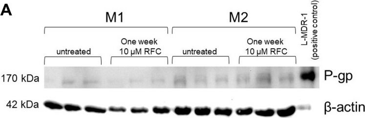 Fig.3.A showing Western Blotting in a Homo sapiens (Human) sample from the publication: Impact of rifampicin on P-glycoprotein (ABCB1) expression in M1 and M2 macrophages derived from the THP-1 monocytic cell line or peripheral blood mononuclear cells.
