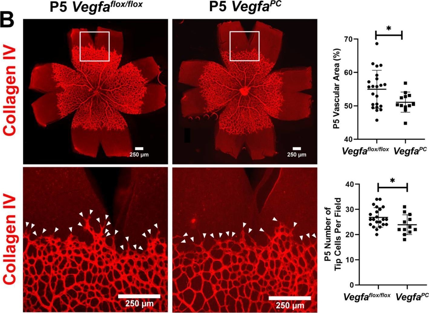 Fig.2.B showing Immunohistochemistry-immunofluorescence in a Mus musculus (House mouse) sample from the publication: Pericyte Expression of VEGF-A Minimally Impacts Ocular Vascular Development and Neovascularization.