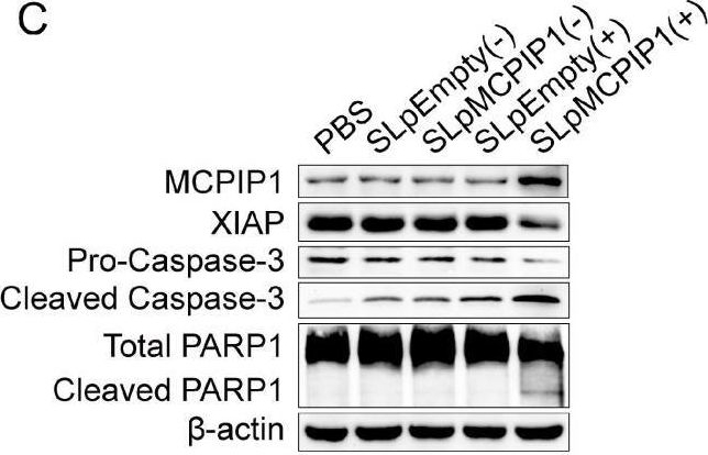 Fig.7.C showing Western Blotting in a Homo sapiens (Human) sample from the publication: MCPIP1 Elicits a Therapeutic Effect on Cervical Cancer by Facilitating XIAP mRNA Decay via Its Endoribonuclease Activity.