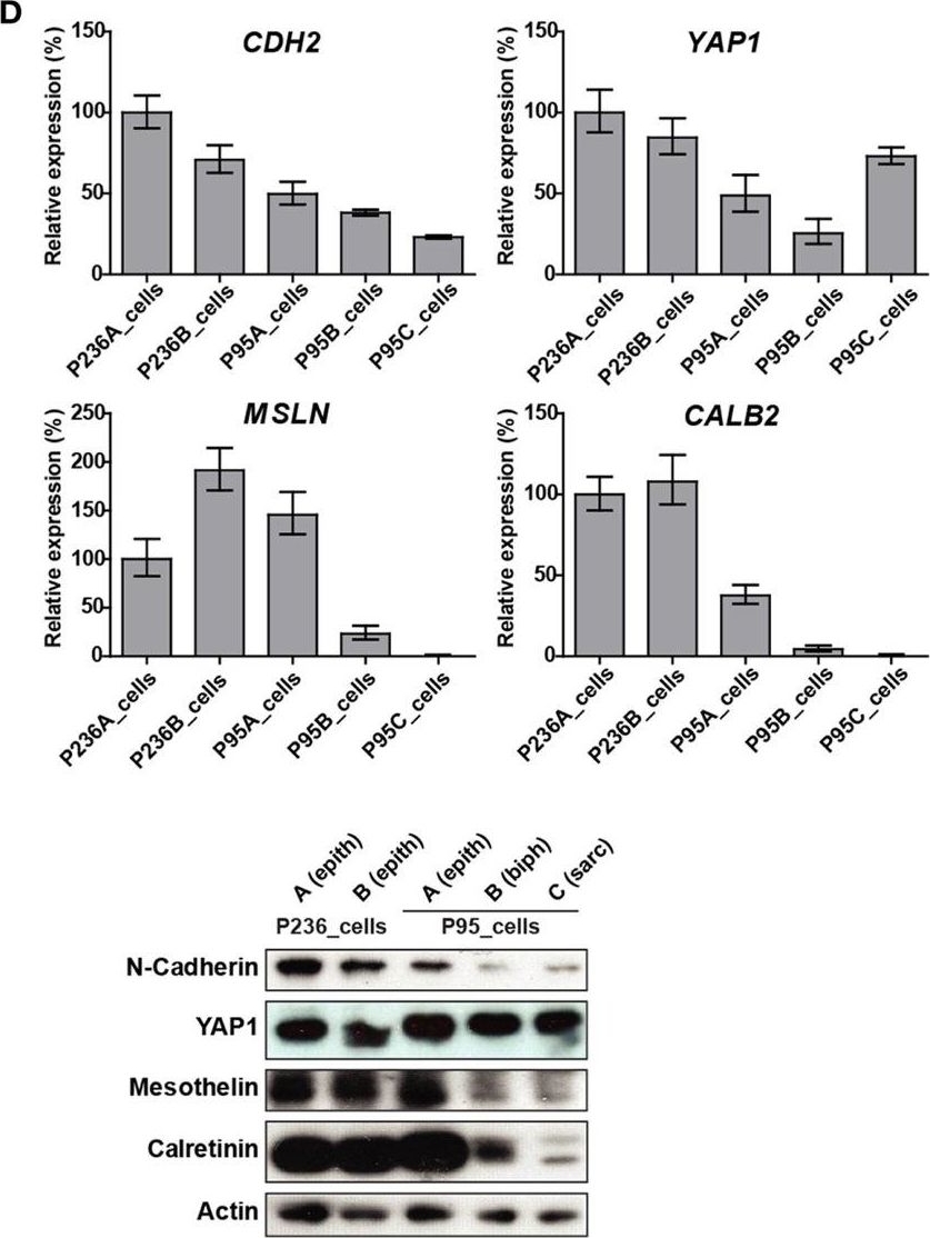 Fig.1.D showing Western Blotting in a Homo sapiens (Human) sample from the publication: Live-Cell Mesothelioma Biobank to Explore Mechanisms of Tumor Progression.
