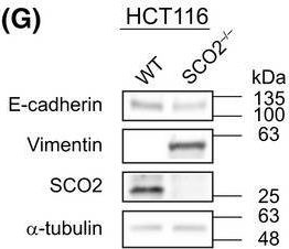 Fig.5.G showing Western Blotting in a Homo sapiens (Human) sample from the publication: Mitochondrial complex IV defects induce metabolic and signaling perturbations that expose potential vulnerabilities in HCT116 cells.