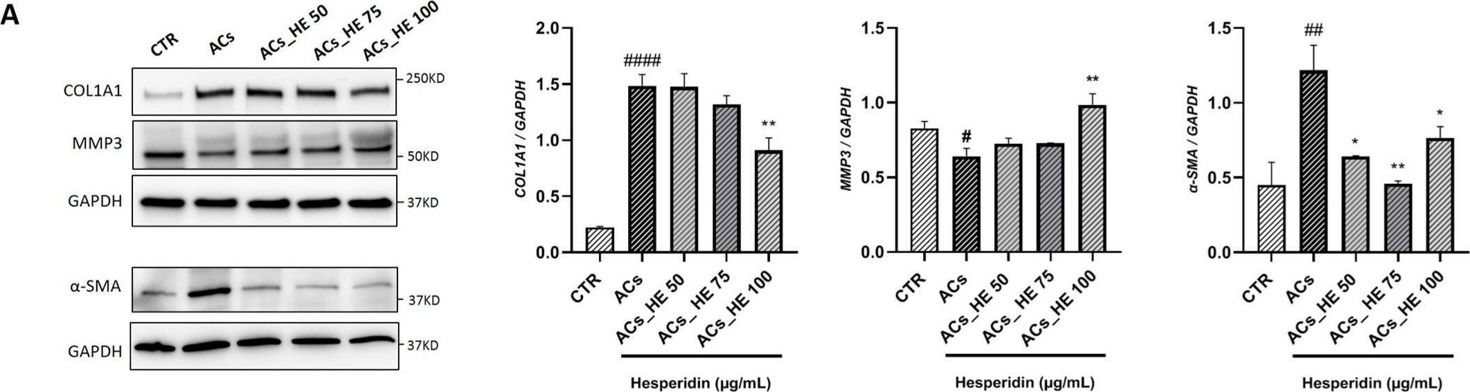 Fig.4.A showing Western Blotting from the publication: Hesperidin Is a Promising Nutraceutical Compound in Counteracting the Progression of NAFLD In Vitro.