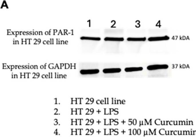 Fig.3.A showing Western Blotting in a Homo sapiens (Human) sample from the publication: Curcumin Inhibits Protease Activated Receptor 2-Induced ERK Phosphorylation Calcium Mobilization and Anti-Apoptotic Signaling in Inflammation-Driven Colorectal Cancer Cells.