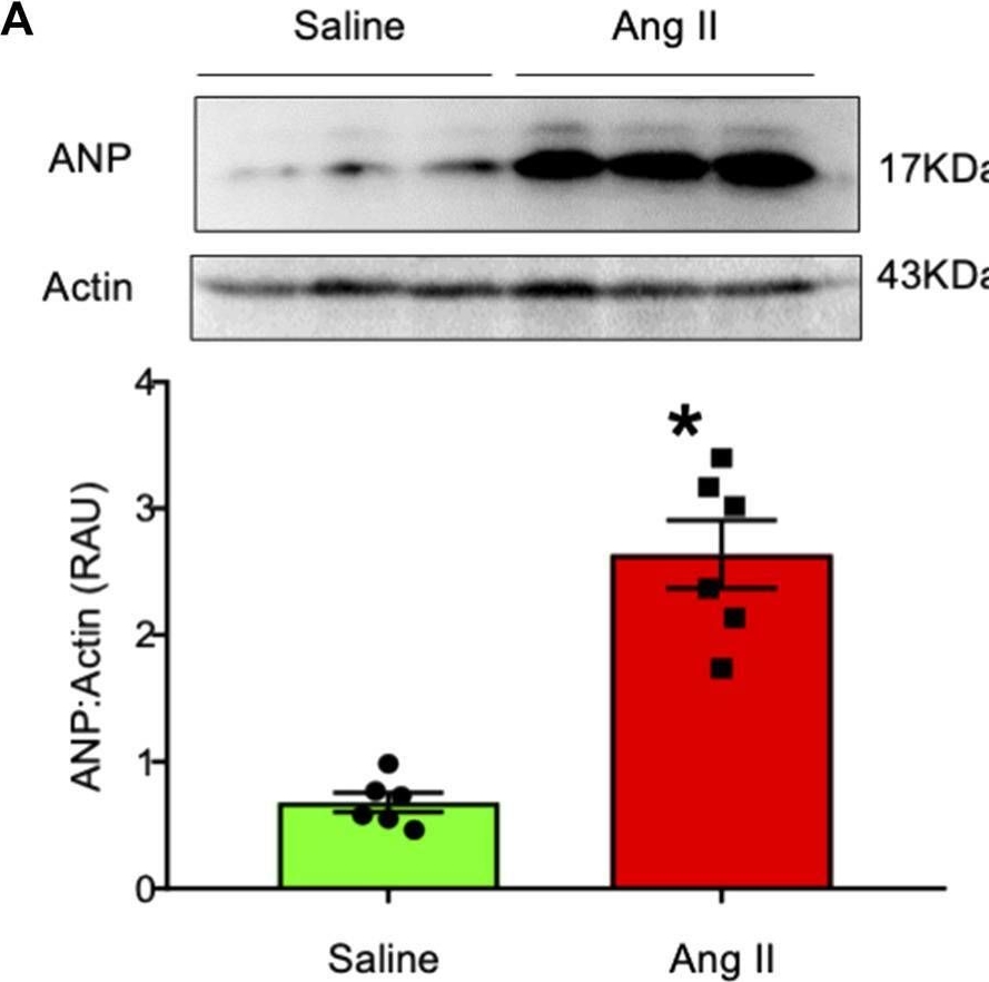 Fig.7.A showing Western Blotting in a Rattus norvegicus (Rat) sample from the publication: Enhanced central sympathetic tone induces heart failure with preserved ejection fraction (HFpEF) in rats.