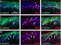 Fig.1.K,L,M showing Immunohistochemistry-immunofluorescence in a Lizard sample from the publication: Regeneration of reptilian scales after wounding: neogenesis, regional difference, and molecular modules.