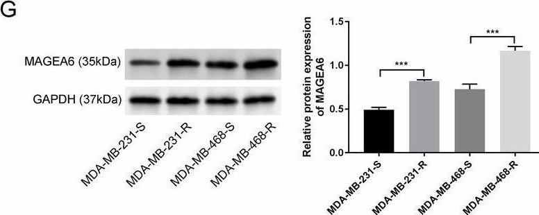 Fig.1.G showing Western Blotting in a Homo sapiens (Human) sample from the publication: Targeting oncogenic MAGEA6 sensitizes triple negative breast cancer to doxorubicin through its autophagy and ferroptosis by stabling AMPKα1.