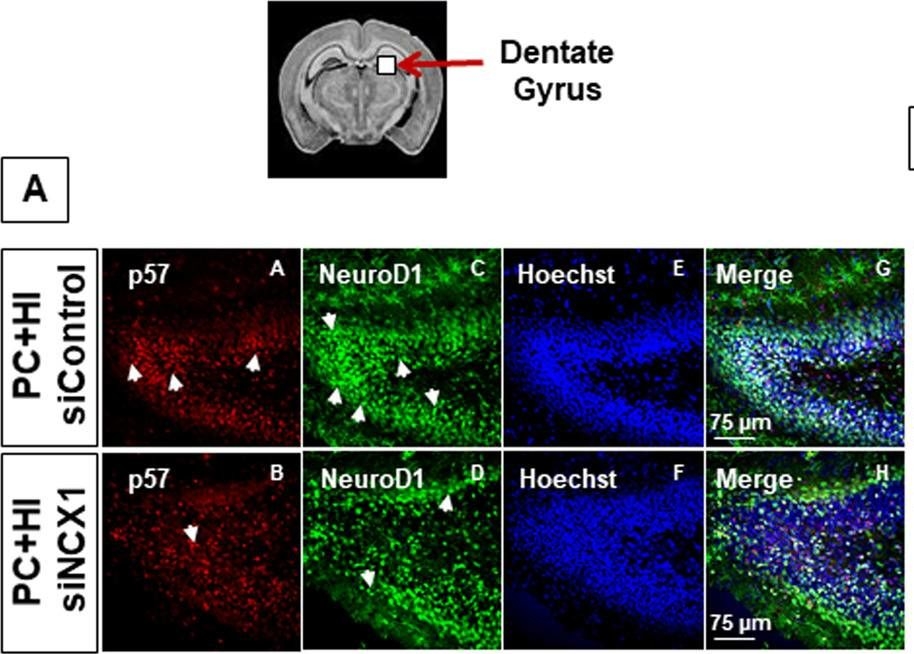 Fig.7.A showing Immunohistochemistry-immunofluorescence in a Mus musculus (House mouse) sample from the publication: Preconditioning in hypoxic-ischemic neonate mice triggers Na+-Ca2+ exchanger-dependent neurogenesis.