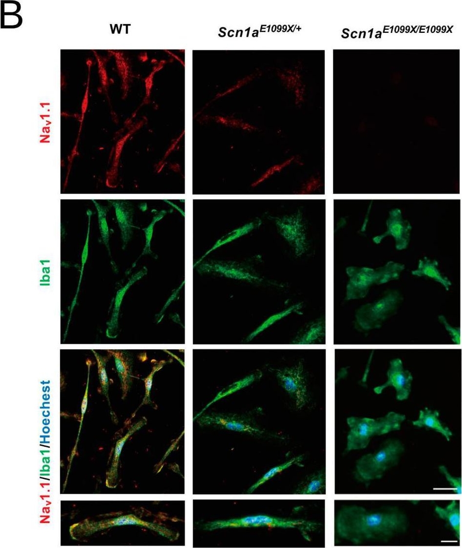 Fig.1.B showing Immunocytochemistry-immunofluorescence in a Mus musculus (House mouse) sample from the publication: Microglia-Impaired Phagocytosis Contributes to the Epileptogenesis in a Mouse Model of Dravet Syndrome.