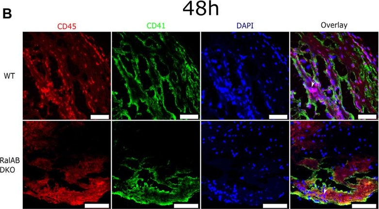 Fig.2.B showing Immunohistochemistry-immunofluorescence in a Mus musculus (House mouse) sample from the publication: Critical role for platelet Ral GTPases in regulating venous thrombosis in mice.