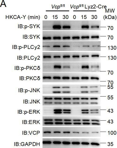 Fig.4.A showing Western Blotting from the publication: The protein segregase VCP/p97 promotes host antifungal defense via regulation of SYK activation.
