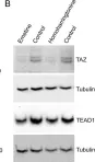 Fig.8.B showing Western Blotting in a Mus musculus (House mouse) sample from the publication: Increased expression of the tight junction protein TJP1/ZO-1 is associated with upregulation of TAZ-TEAD activity and an adult tissue stem cell signature in carfilzomib-resistant multiple myeloma cells and high-risk multiple myeloma patients.