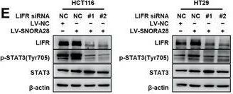 Fig.4.E showing Western Blotting from the publication: SNORA28 Promotes Proliferation and Radioresistance in Colorectal Cancer Cells through the STAT3 Pathway by Increasing H3K9 Acetylation in the LIFR Promoter.