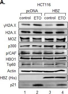 Fig.1.A showing Western Blotting in a Homo sapiens (Human) sample from the publication: Human T-cell leukemia virus type-1-encoded protein HBZ represses p53 function by inhibiting the acetyltransferase activity of p300/CBP and HBO1.