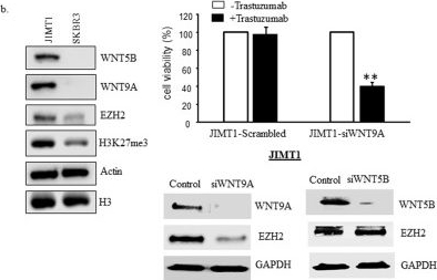 Fig.4.B showing Western Blotting in a Homo sapiens (Human) sample from the publication: Utilization of NGS technologies to investigate transcriptomic and epigenomic mechanisms in trastuzumab resistance.