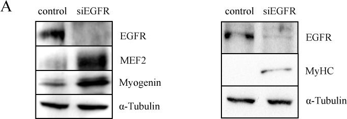 Fig.3.A showing Western Blotting from the publication: Epidermal growth factor receptor down-regulation triggers human myoblast differentiation.
