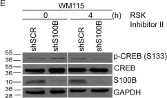 Fig.6.E showing Western Blotting from the publication: The calcium-binding protein S100B reduces IL6 production in malignant melanoma via inhibition of RSK cellular signaling.