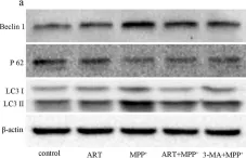 Fig.5.A showing Western Blotting from the publication: Artemisinin attenuated oxidative stress and apoptosis by inhibiting autophagy in MPP+-treated SH-SY5Y cells.