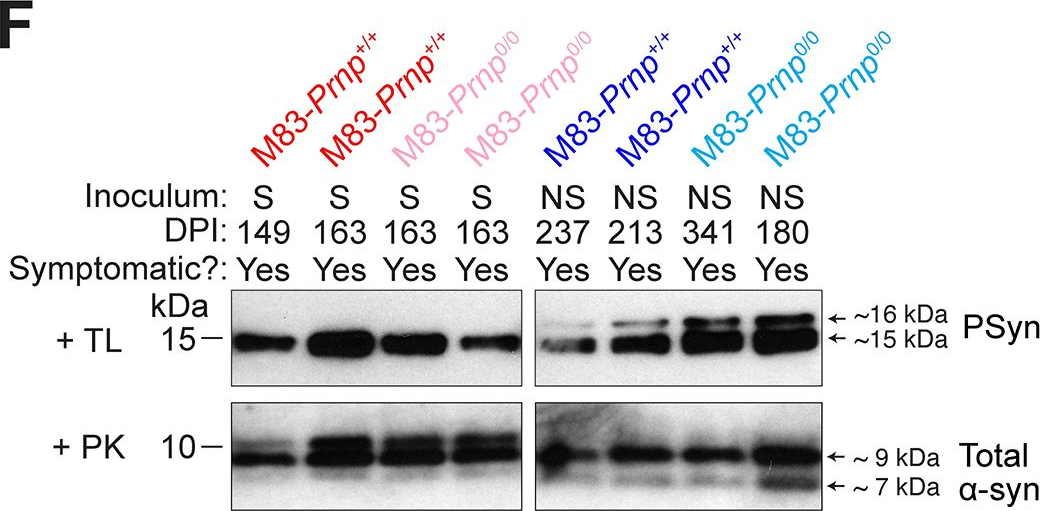 Fig.2.F showing Western Blotting from the publication: α-Synuclein strain propagation is independent of cellular prion protein expression in a transgenic synucleinopathy mouse model.