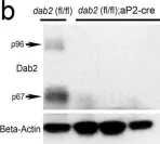 Fig.3.B showing Western Blotting in a Mus musculus (House mouse) sample from the publication: Disabled-2 Determines Commitment of a Pre-adipocyte Population in Juvenile Mice.