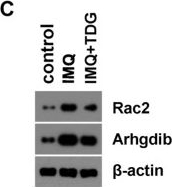 Fig.5.C showing Western Blotting from the publication: Transcriptomic Analysis of the Mechanisms for Alleviating Psoriatic Dermatitis Using Taodan Granules in an Imiquimod-Induced Psoriasis-like Mouse Model.