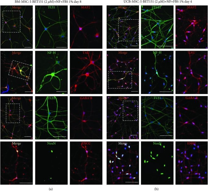 Fig.3.A,B showing Immunohistochemistry-immunofluorescence in a Homo sapiens (Human) sample from the publication: Neuronal Transdifferentiation Potential of Human Mesenchymal Stem Cells from Neonatal and Adult Sources by a Small Molecule Cocktail.
