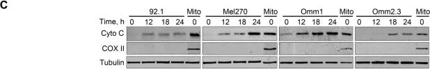 Fig.2.C showing Western Blotting in a Homo sapiens (Human) sample from the publication: Salinomycin effectively eliminates cancer stem-like cells and obviates hepatic metastasis in uveal melanoma.