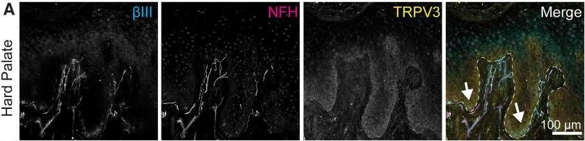 Fig.2.A showing Immunohistochemistry-immunofluorescence in a Homo sapiens (Human) sample from the publication: Localization of TRP Channels in Healthy Oral Mucosa from Human Donors.
