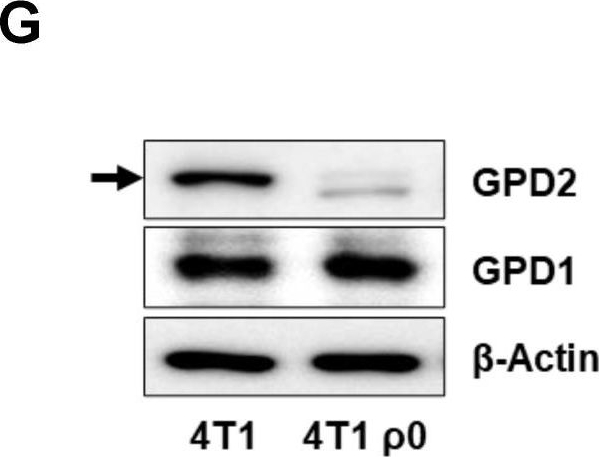 Fig.1.G showing Western Blotting from the publication: Non-bioenergetic roles of mitochondrial GPD2 promote tumor progression.