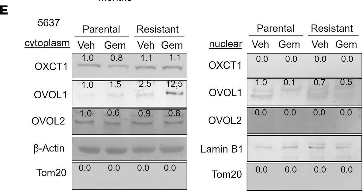 Fig.5.E showing Western Blotting in a Homo sapiens (Human) sample from the publication: Targeting ketone body metabolism in mitigating gemcitabine resistance.