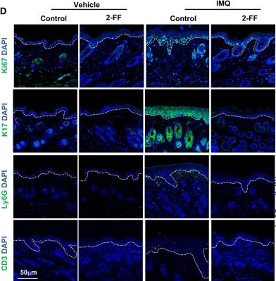 Fig.2.D showing Immunohistochemistry-immunofluorescence in a Mus musculus (House mouse) sample from the publication: FUT11-Driven fucosylation coordinates K63 ubiquitination of keratin 17 to sustain psoriatic keratinocytes hyperproliferation.