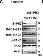 Fig.2.C showing Western Blotting in a Homo sapiens (Human) sample from the publication: Sphingosine-1-Phosphate Receptor 3 Confers Tumor Metastasis in Lung Cancer Resistant to Third-Generation EGFR Inhibitor.